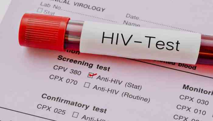 HIV Screening in Singapore: What Happens After Testing Positive for the Disease?