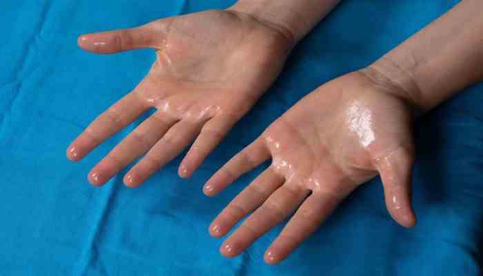 Breaking the Sweat Barrier: How Modern Technology is Revolutionizing Hyperhidrosis Treatment in Singapore